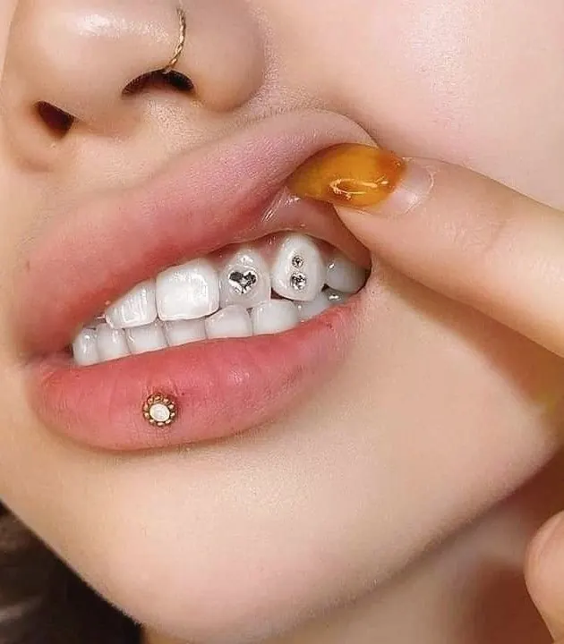Decorative tooth gems on front teeth