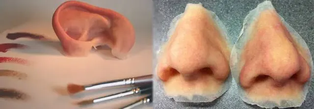 Examples of custom ear and nose facial prostheses