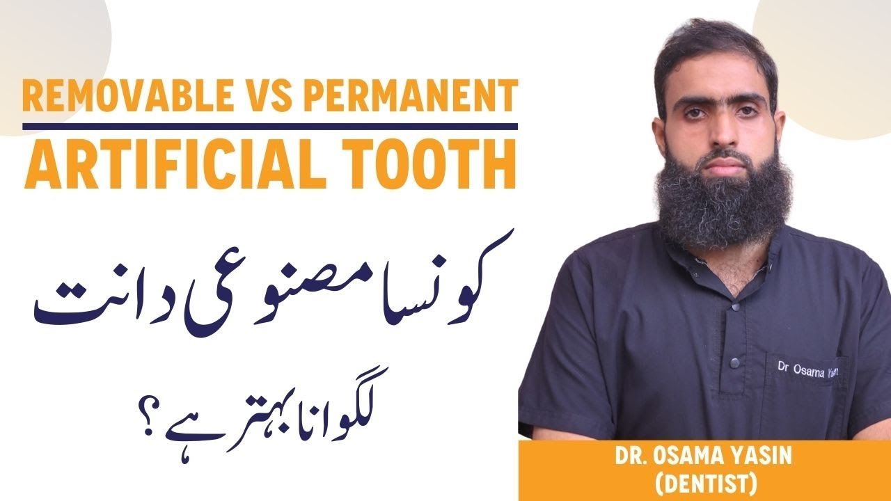 Video thumbnail: Replacing a missing tooth with Dr. Osama Yasin