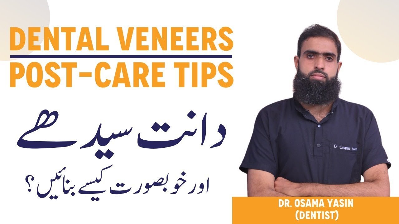 Video thumbnail: Veneers: complications & aftercare with Dr. Osama Yasin