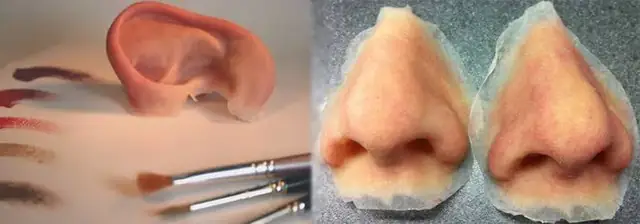 Maxillofacial prostheses consultation