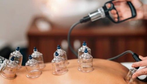 Cupping Therapy Icon